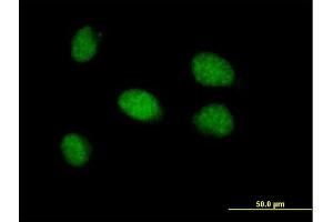 Immunofluorescence of purified MaxPab antibody to CDYL2 on HeLa cell. (CDYL2 Antikörper  (AA 1-506))