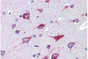 Human Brain, Cortex (formalin-fixed, paraffin-embedded) stained with ALS2 antibody ABIN351462 at 3. (ALS2 Antikörper  (AA 1644-1657))