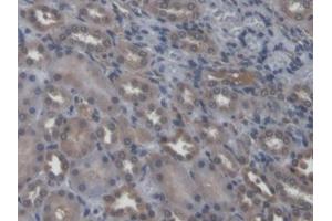 DAB staining on IHC-P; Samples: Rat Kidney Tissue (NEU2 Antikörper  (AA 185-379))