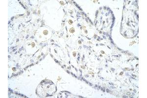 Rabbit Anti-DLX5 antibody        Paraffin Embedded Tissue:  Human Placenta cell   Cellular Data:  Epithelial cells of renal tubule  Antibody Concentration:   4. (DLX5 Antikörper  (C-Term))