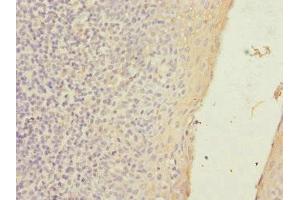 Immunohistochemistry of paraffin-embedded human tonsil tissue using ABIN7170174 at dilution of 1:100 (SLC23A2 Antikörper  (AA 1-90))