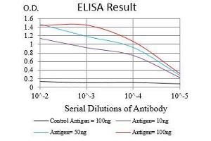 Black line: Control Antigen (100 ng), Purple line: Antigen(10 ng), Blue line: Antigen (50 ng), Red line: Antigen (100 ng), (CA9 Antikörper  (AA 37-186))