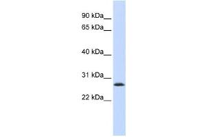 Western Blotting (WB) image for anti-LSM12 Homolog B (LSM12B) antibody (ABIN2459597) (LSM12B Antikörper)