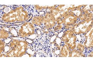 Detection of IL10Rb in Human Kidney Tissue using Polyclonal Antibody to Interleukin 10 Receptor Beta (IL10Rb) (IL10RB Antikörper  (AA 87-243))