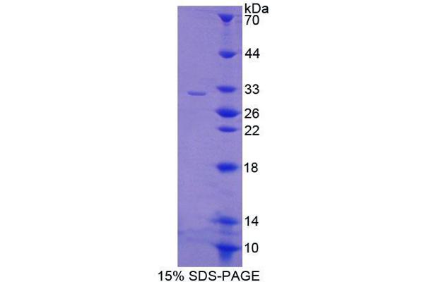 CREB5 Protein (AA 308-508) (T7 tag,His tag)
