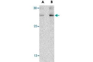 Western blot analysis of TSLP in Jurkat cell lysate with TSLP polyclonal antibody  at (A) 1 and (B) 2 ug/mL .
