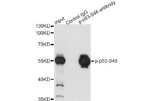 Immunoprecipitation analysis of 200 μg extracts of 293 cells both treated by UV and serum using 2. (p53 Antikörper  (pSer46))