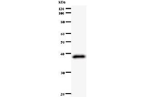 Western Blotting (WB) image for anti-Zw10 Kinetochore Protein (ZW10) antibody (ABIN933128)