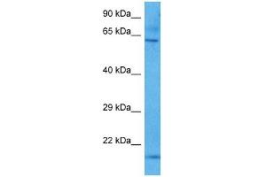 Host:  Mouse  Target Name:  KCNQ1  Sample Tissue:  Mouse Brain  Antibody Dilution:  1ug/ml (KCNQ1 Antikörper  (N-Term))