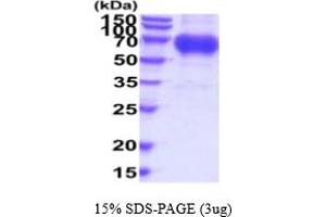 SDS-PAGE (SDS) image for Osteoactivin (GPNMB) (AA 22-474) protein (His tag) (ABIN5854811) (Osteoactivin Protein (GPNMB) (AA 22-474) (His tag))