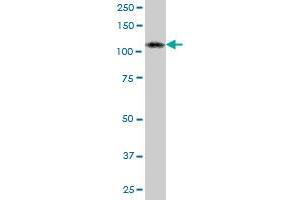 Western Blotting (WB) image for anti-Adenosine Deaminase, RNA-Specific (ADAR) (AA 1-1226) antibody (ABIN513112)