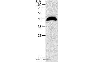 Western blot analysis of Human liver cancer tissue, using OPRL1 Polyclonal Antibody at dilution of 1:1100