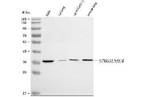 Western blot analysis of ST6GALNAC4 using anti-ST6GALNAC4 antibody (ABIN7601573).
