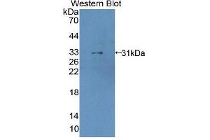 Western blot analysis of the recombinant protein. (LDOC1 Antikörper  (AA 1-146))