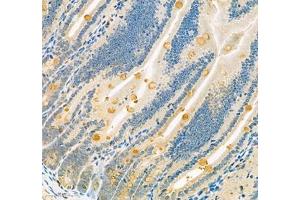 Immunohistochemistry of paraffin embedded mouse small intestine using Znt1 (ABIN7075672) at dilution of 1:650 (300x lens) (SLC30A1 Antikörper)