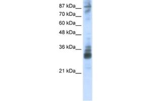 Western Blotting (WB) image for anti-RNA (Guanine-9-) Methyltransferase Domain Containing 2 (RG9MTD2) antibody (ABIN2462341) (RG9MTD2 Antikörper)