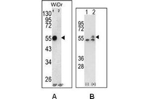 A: Western blot analysis of ATP5B Antibody (Center) Cat. (ATP Synthase Subunit beta (AtpB) (AA 142-171), (Middle Region), (Subunit beta) Antikörper)