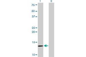 Western Blotting (WB) image for anti-beta-2-Microglobulin (B2M) (AA 1-119) antibody (ABIN560019)