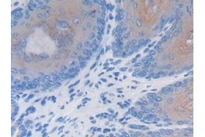 Detection of LRG1 in Mouse Esophagus Tissue using Polyclonal Antibody to Leucine Rich Alpha-2-Glycoprotein 1 (LRG1) (LRG1 Antikörper  (AA 136-342))