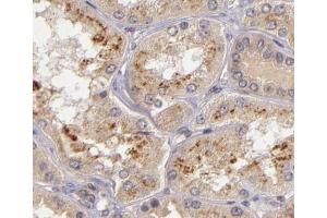 ABIN6266579 at 1/200 staining human kidney tissue sections by IHC-P. (NOS2 Antikörper  (C-Term))