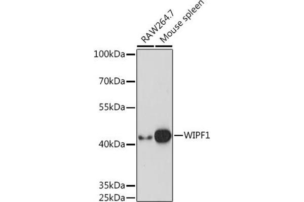 WIPF1 Antikörper  (AA 400-500)