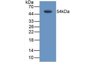Western Blotting (WB) image for anti-Transmembrane Protein 27 (TMEM27) (AA 12-222) antibody (ABIN7428101)