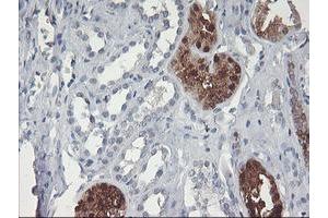 Immunohistochemical staining of paraffin-embedded Human Kidney tissue using anti-GBA3 mouse monoclonal antibody. (GBA3 Antikörper  (AA 1-150, AA 370-469))