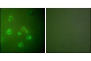 Immunofluorescence analysis of COS7 cells, using GRP78 antibody (ABIN5976417). (GRP78 Antikörper  (C-Term))