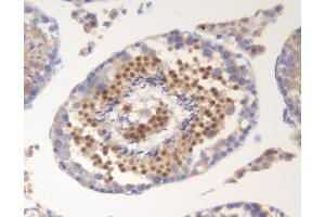 IHC analysis of SOX6 using anti-SOX6 antibody (ABIN7603012).