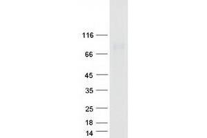 DTX2 Protein (Transcript Variant 1) (Myc-DYKDDDDK Tag)