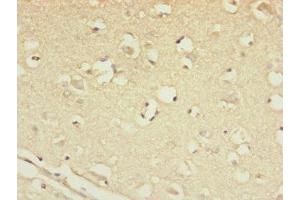Immunohistochemistry of paraffin-embedded human brain tissue using ABIN7147450 at dilution of 1:100