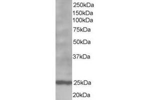 ABIN185269 staining (1µg/ml) of Human Lymph Node lysate (RIPA buffer, 35µg total protein per lane). (Bcl-2 Antikörper  (N-Term))
