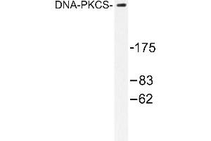 Image no. 2 for anti-Protein Kinase, DNA-Activated, Catalytic Polypeptide (PRKDC) antibody (ABIN265386) (PRKDC Antikörper)
