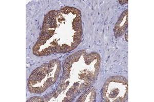 Immunohistochemical staining of human prostate with TOMM20L polyclonal antibody  shows strong cytoplasmic positivity in glandular cells. (TOMM20L Antikörper)