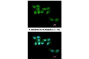 ICC/IF Image Immunofluorescence analysis of paraformaldehyde-fixed A431, using UVSSA antibody [N1N2], N-term , at 1:200 dilution. (UVSSA/KIAA1530 Antikörper  (N-Term))