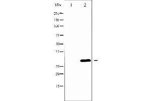 Western blot analysis of BCL-XL phosphorylation expression in UV treated 293 whole cell lysates,The lane on the left is treated with the antigen-specific peptide.