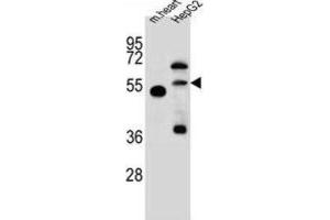 Western Blotting (WB) image for anti-Nitric Oxide Synthase Trafficker (NOSTRIN) antibody (ABIN2997567) (NOSTRIN Antikörper)
