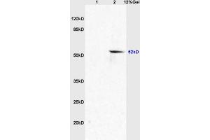 Lane 1: mouse embryo lysates Lane 2: mouse brain lysates probed with Anti AVPR2 Polyclonal Antibody, Unconjugated (ABIN705746) at 1:200 in 4 °C. (SLC2A8 Antikörper  (AA 401-477))