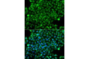 Immunofluorescence analysis of A549 cell using CFHR3 antibody. (CFHR3 Antikörper)