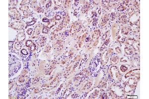 Immunohistochemistry (Paraffin-embedded Sections) (IHC (p)) image for anti-Arginase, Type II (ARG2) (AA 181-290) antibody (ABIN1387473)