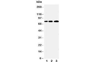Western blot testing of PLK2 antibody and Lane 1:  A431;  2: 293T;  3: COLO320 cell lysate