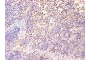 Immunohistochemical of paraffin-embedded human lymph node tissue using ABIN7152718 at dilution of 1:200 (FTL Antikörper)
