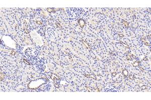 Detection of LDHB in Human Kidney Tissue using Polyclonal Antibody to Lactate Dehydrogenase B (LDHB) (LDHB Antikörper  (AA 1-334))