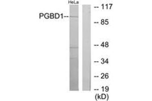 Western blot analysis of extracts from HeLa cells, using PGBD1 Antibody.