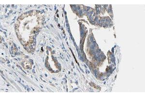 ABIN6277641 at 1/100 staining Human prostate tissue by IHC-P. (ATIC Antikörper  (C-Term))