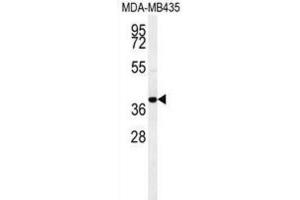 Western Blotting (WB) image for anti-Chemokine (C-C Motif) Receptor 8 (CCR8) antibody (ABIN2995670)