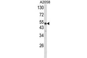 Western blot analysis of ANXA7 Antibody (Center) in A2058 cell line lysates (35ug/lane). (Annexin VII Antikörper  (Middle Region))