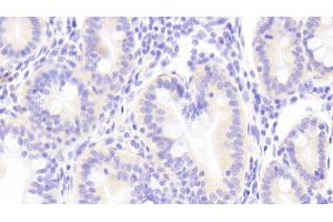 Detection of TECK in Human Small intestine Tissue using Polyclonal Antibody to Thymus Expressed Chemokine (TECK) (CCL25 Antikörper  (AA 24-150))