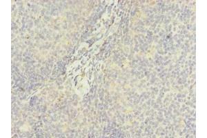 Immunohistochemistry of paraffin-embedded human tonsil tissue using ABIN7144990 at dilution of 1:100 (DDX42 Antikörper  (AA 519-819))