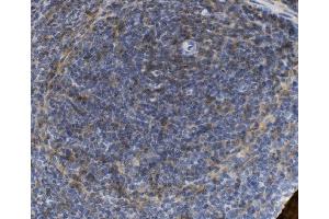 IHC analysis of SELPLG using anti-SELPLG antibody (ABIN7600341). (SELPLG Antikörper  (AA 18-420))